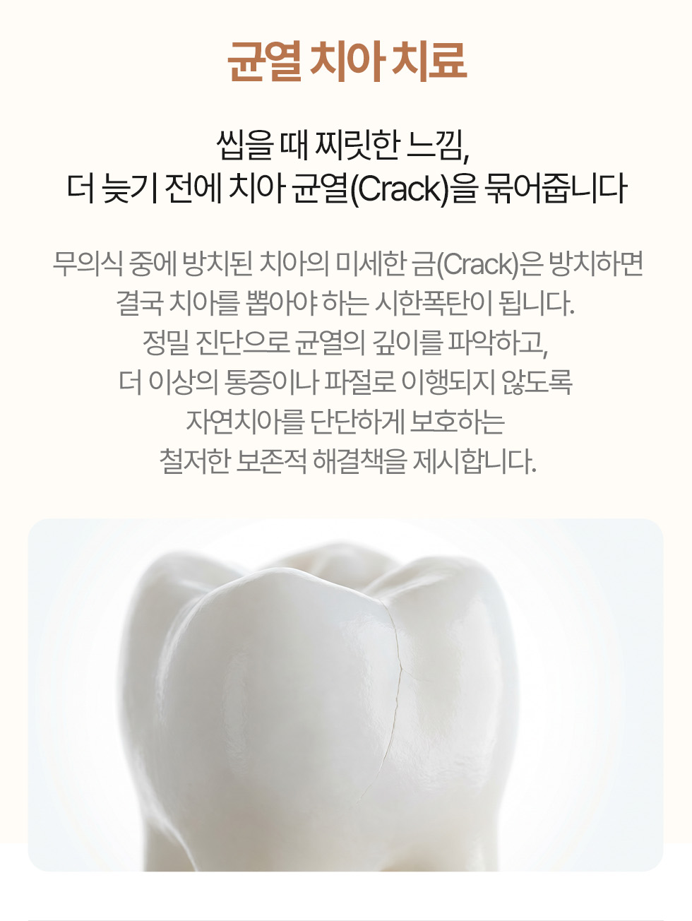 균열 치아 치료 - 자연치아 보존 솔루션