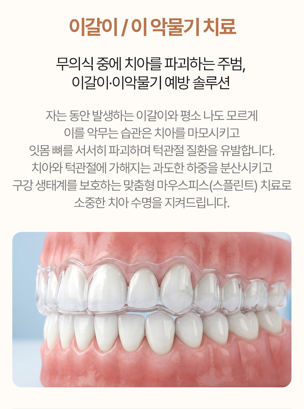 이갈이와 이 악물기 치료 - 맞춤형 마우스피스