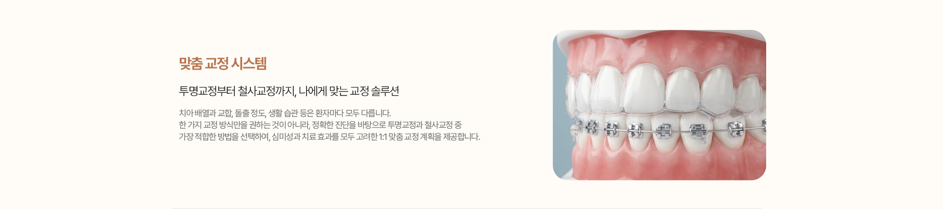맞춤 교정 시스템 - 투명교정부터 철사교정까지