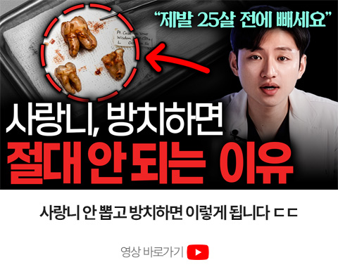 사랑니를 방치하면 절대 안 되는 이유