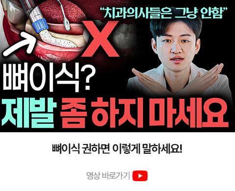 뼈이식 전 꼭 알아야 할 치과 상식
